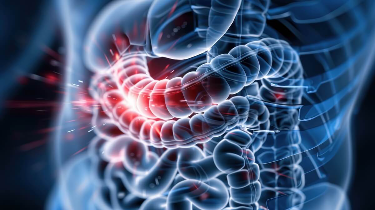 zespół nieszczelnego jelita