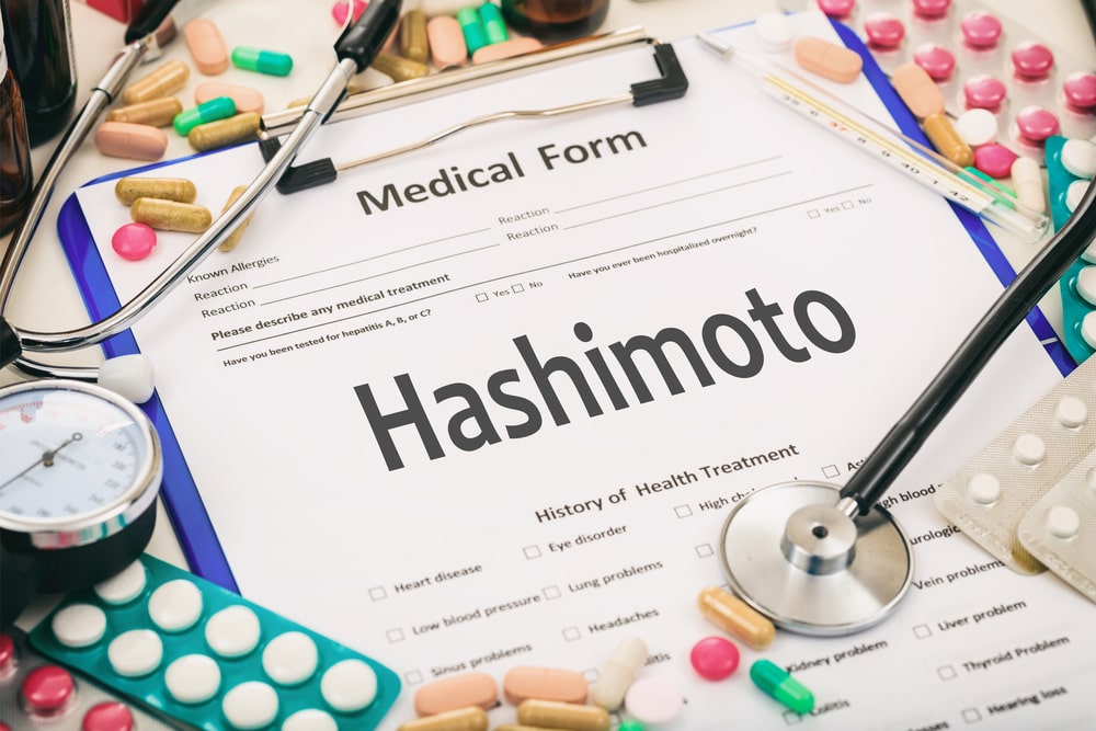 Suplementacja W Hashimoto - Zapaleniu Tarczycy